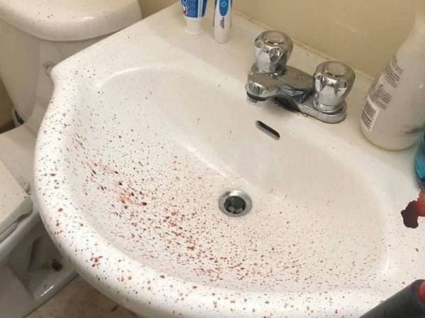 lelaki ini terkejut tengok darah tiba-tiba mengalir di dinding bilik air rumahnya