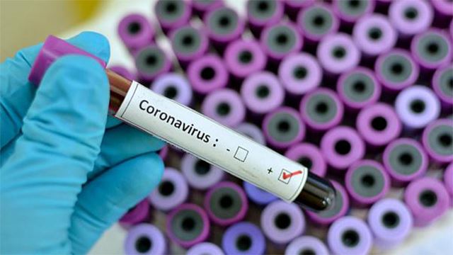 covid-19: jumlah kes positif baharu meningkat, satu kematian baharu dilaporkan