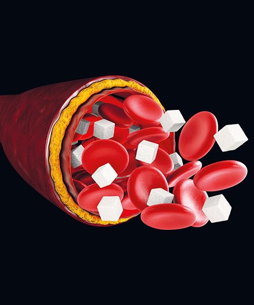 Cepat Jumpa Doktor Jika Ada Tanda Ini, Boleh Jadi Gula Dalam Darah Terlampau Tinggi