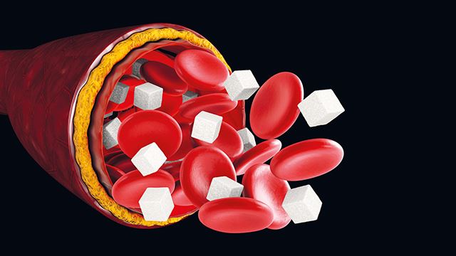 Cepat Jumpa Doktor Jika Ada Tanda Ini, Boleh Jadi Gula Dalam Darah Terlampau Tinggi