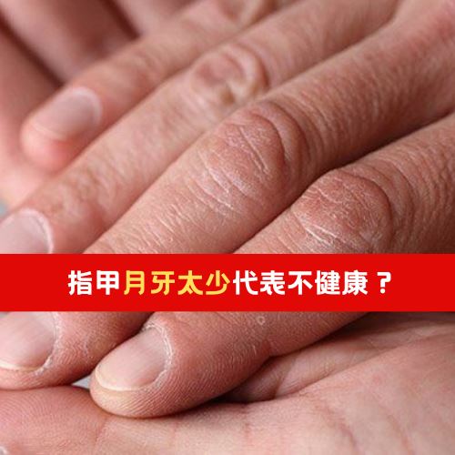 指甲月牙太少代表不健康?中医:当心影响生育!