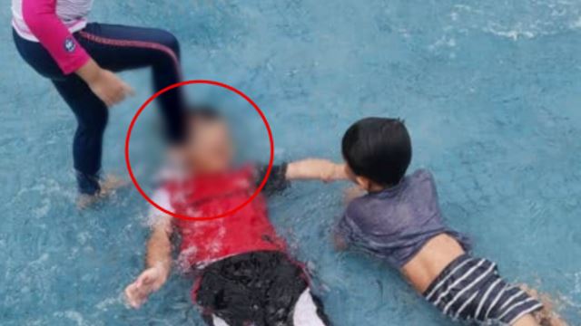 M’sian Mother Urges Parents To Watch Their Kids After Child Stepped On Her Son’s Face At Public Pool