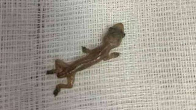 mengadu sakit telinga, rupa-rupanya ada cicak yang sudah 2 hari berada di dalam telinga