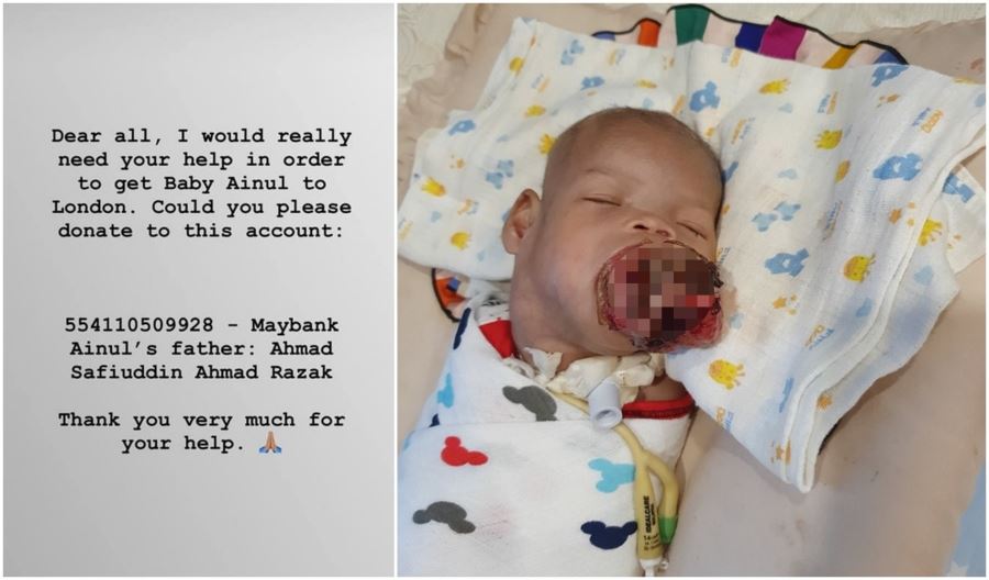 dr amalina seru rakyat malaysia untuk menyumbang kepada adik ainul mardhiah untuk ke london