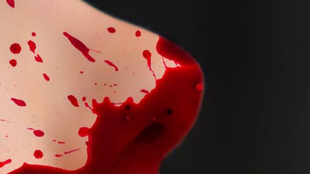 hidung digigit bekas kekasih sehingga putus sebab tak beri peluang kedua untuk buktikan cinta