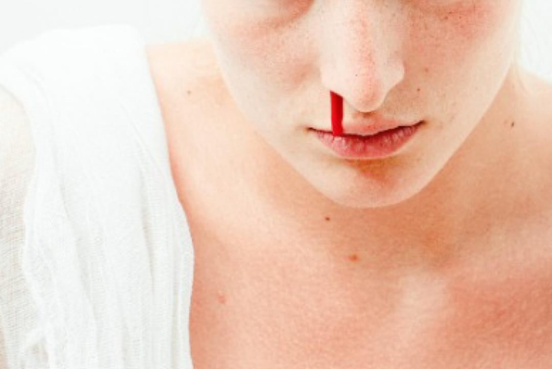 langkah yang boleh diambil sekiranya hidung anda berdarah